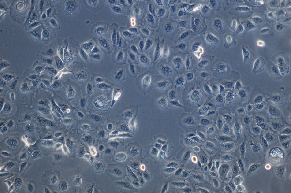 人肺腺癌耐奥希替尼耐药株NCI-H1975+Osimertinib