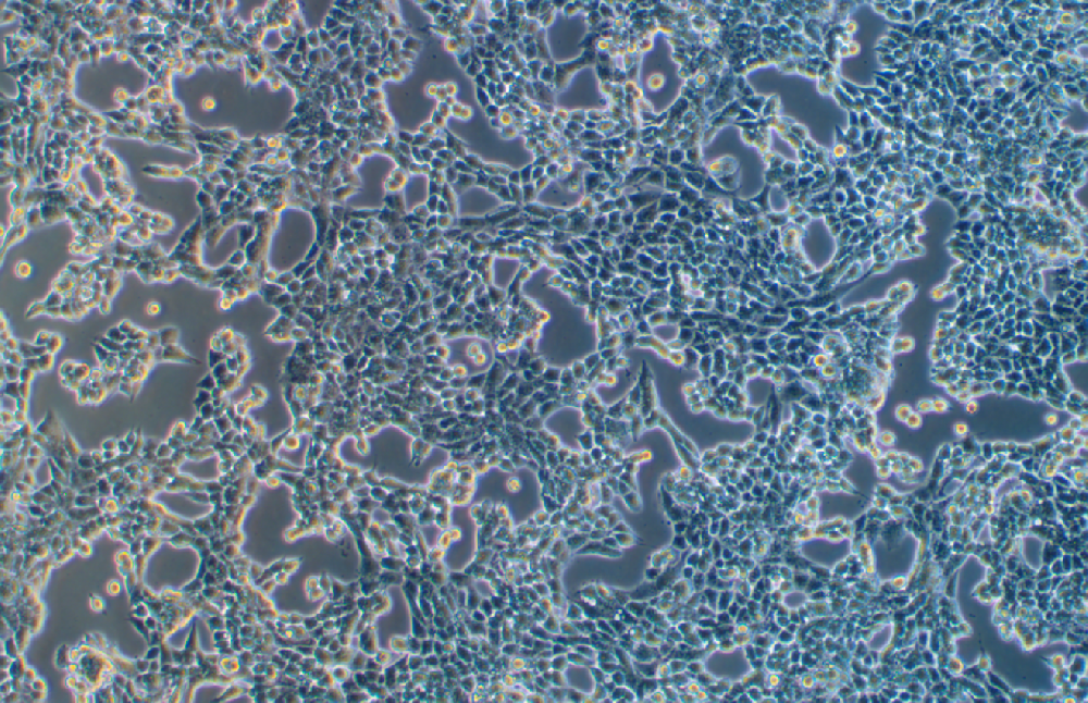 小鼠肺癌细胞奥希替尼耐药株LLC+Osimertinib