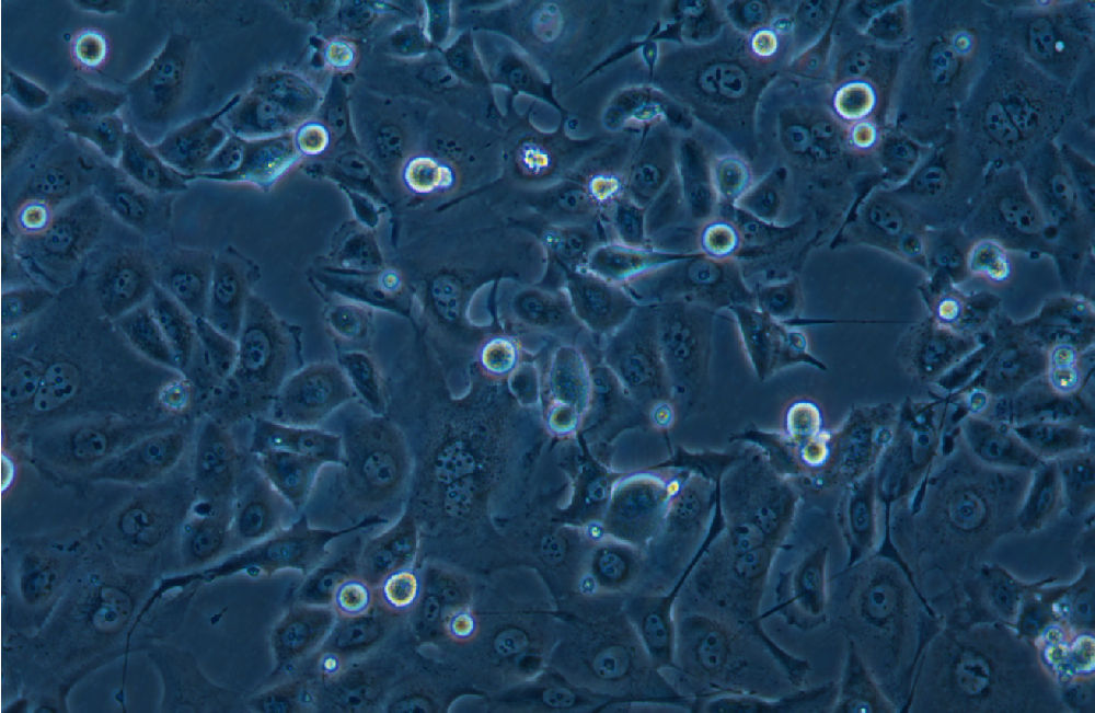 人非小细胞肺癌奥希替尼耐药株HCC-827+Osimertinib